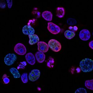 biotech cancer cells