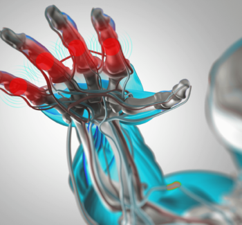 graphic of male hand with rheumatoid arthritis reaching out